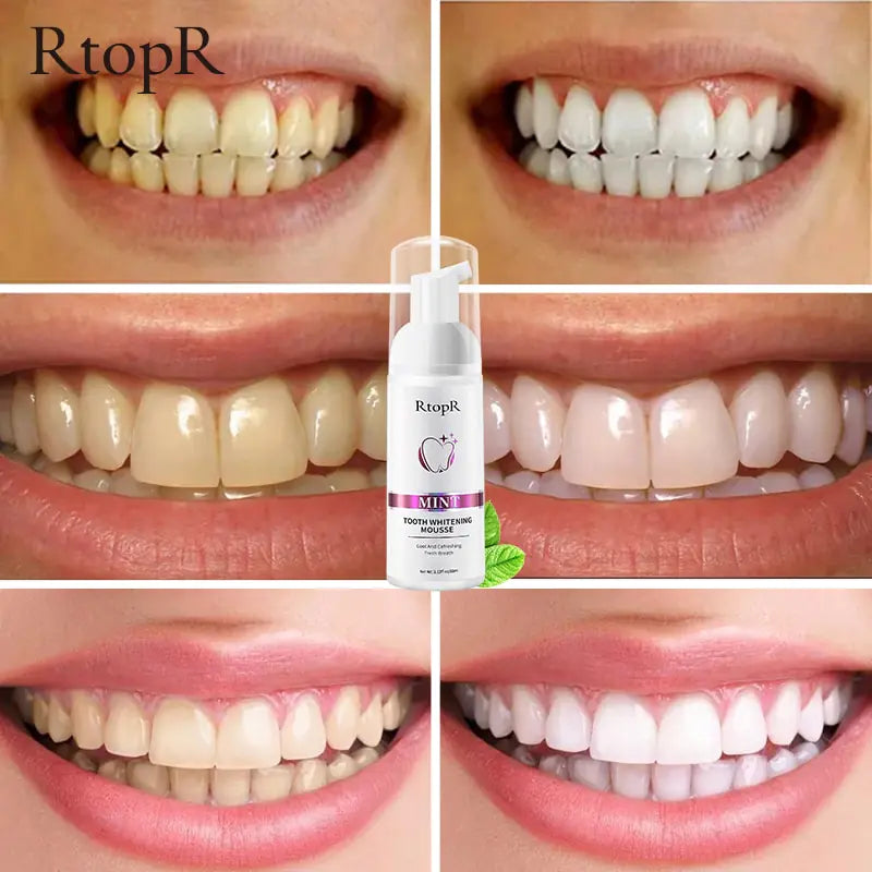 RtopR Teeth Cleansing Whitening Mousse