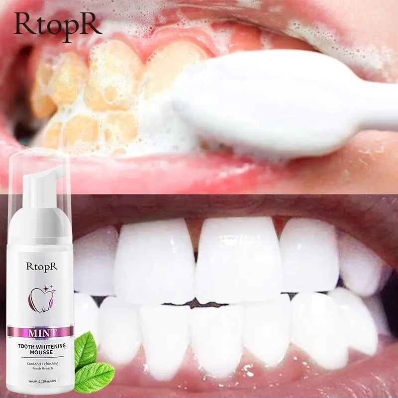 RtopR Teeth Cleansing Whitening Mousse