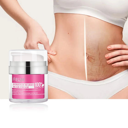 Alike stretch mark removal cream natural vitamin E safe and effective Anti postpartum deep removal