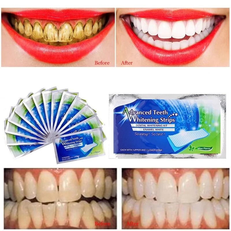 2-Pack 3D White Gel Teeth Whitening Strips for Daily Oral Hygiene Care