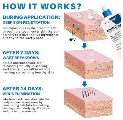 Oveallgo® NanoLipo HPV Genital Warts Eraser Cream Pro