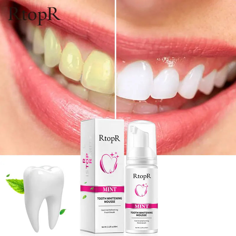 RtopR Teeth Cleansing Whitening Mousse