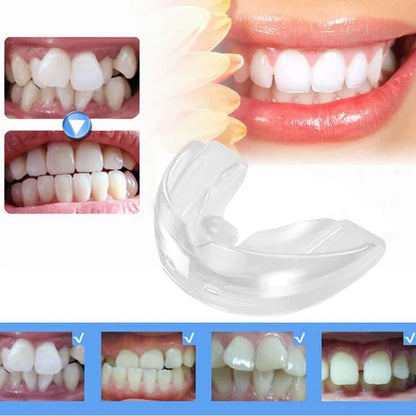 Braces Alignment Trainer Teeth