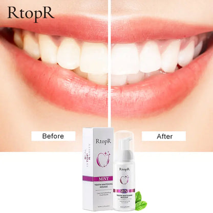 RtopR Teeth Cleansing Whitening Mousse