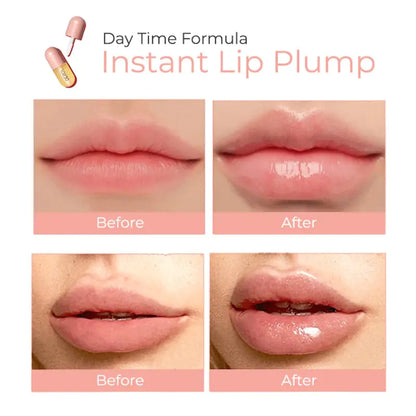 DEROL™ Lip Plumper Kit