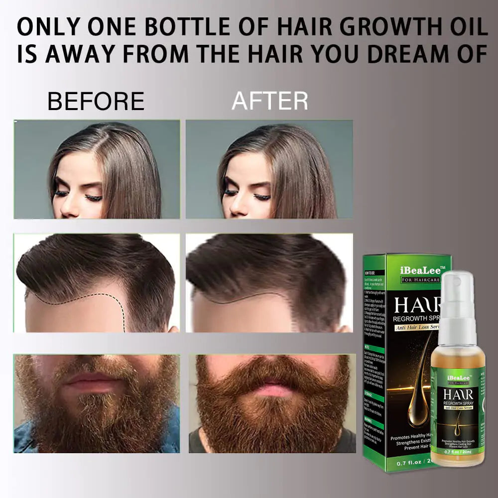 Ginger Hair Growth Spray