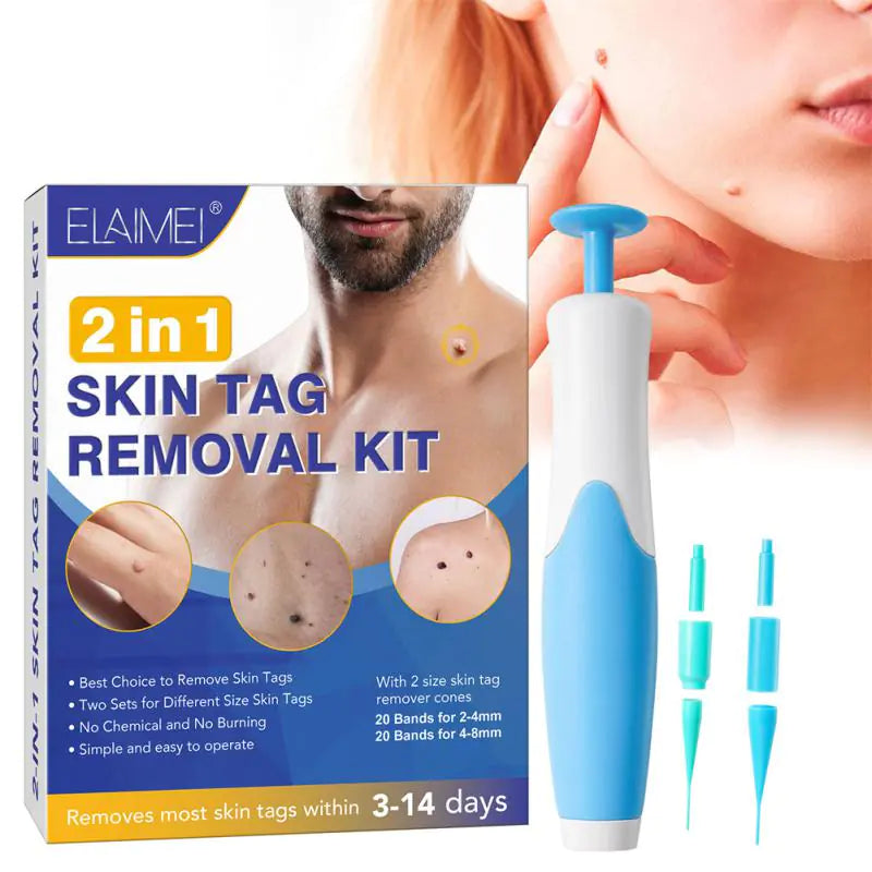 Skin Tag Remover Kit