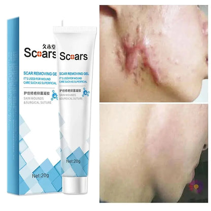 New Herbal Scar Repair Cream