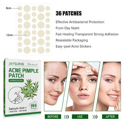 Acne Pimple Patches